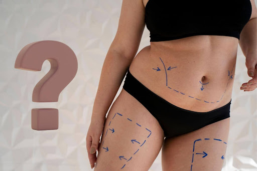 Are There Any Side Effects of Liposuction?